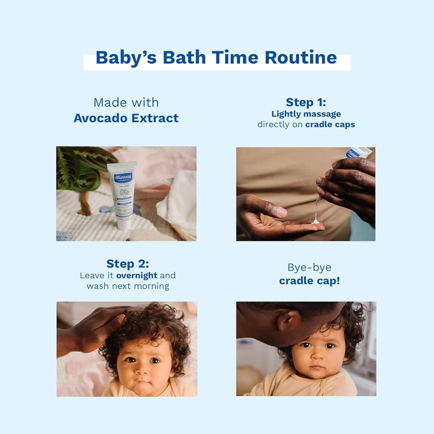 Mustela Baby Cradle Cap Cream - 40ml