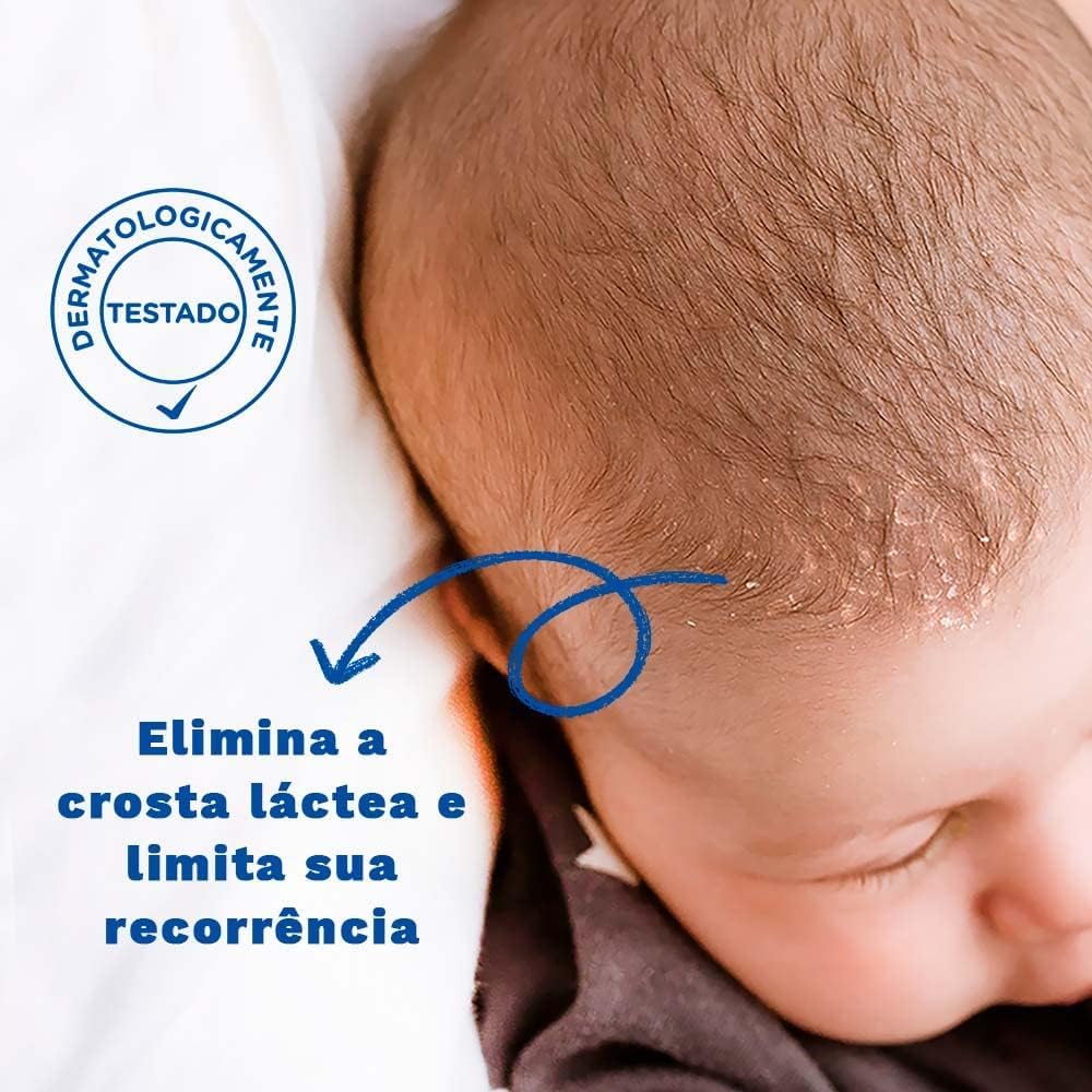 Mustela Baby Cradle Cap Cream - 40ml