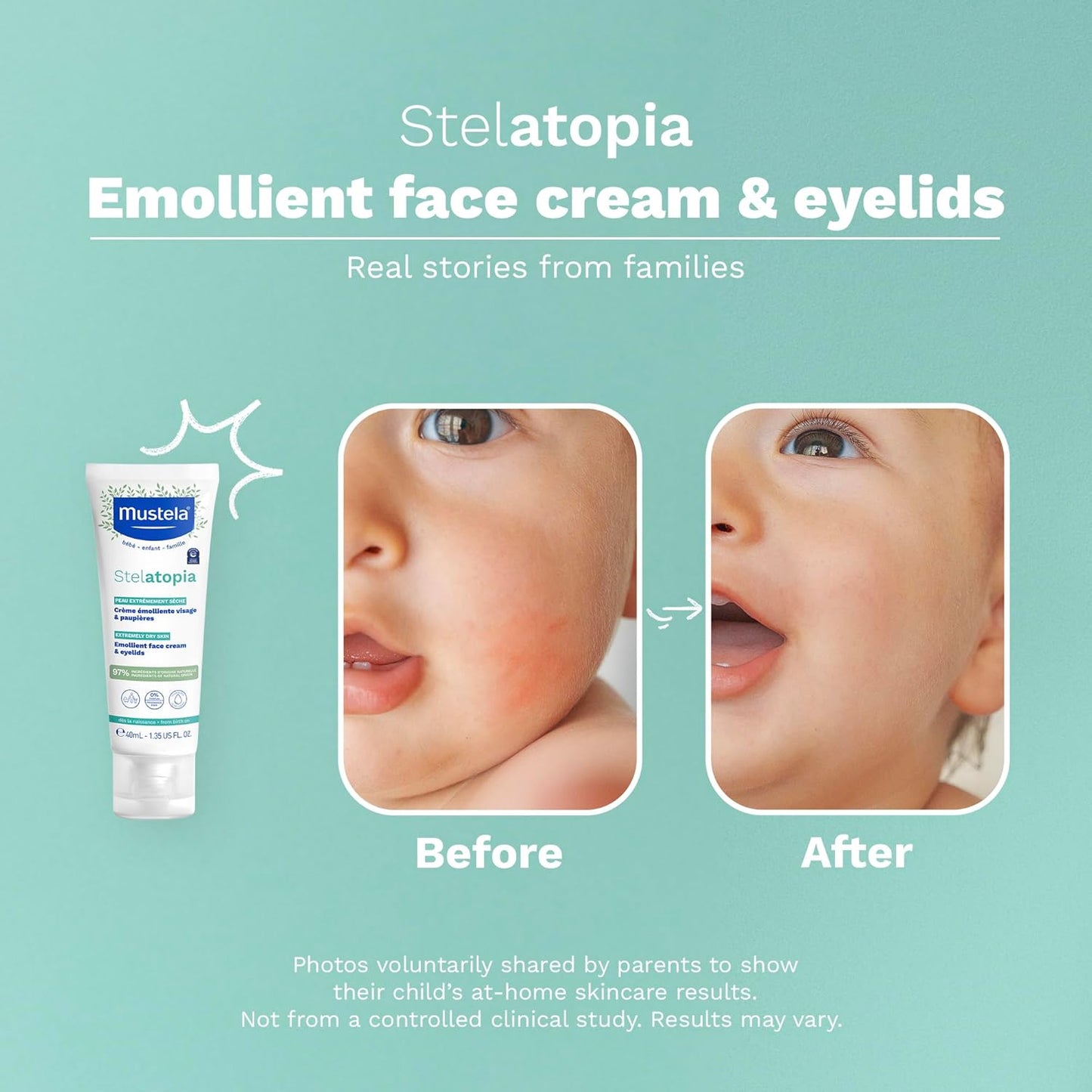 Mustela Stelatopia Emollient Face Cream - 40ml