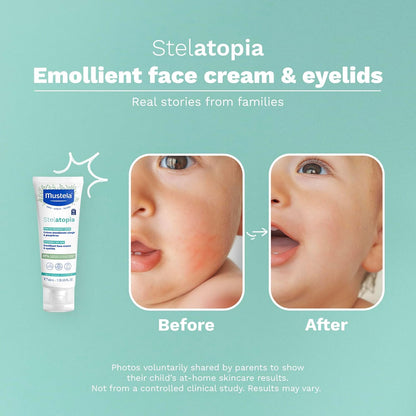 Mustela Stelatopia Emollient Face Cream - 40ml